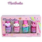 MARTINELIA SMALTI E ANELLI